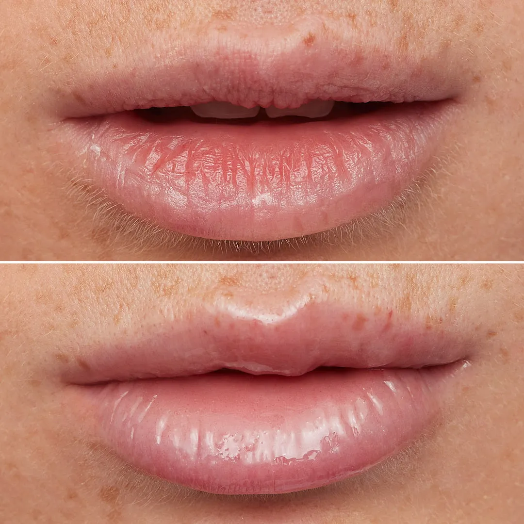 Wonderskin Lip Rehab Serum Oil lipolie Clear met sheaboter