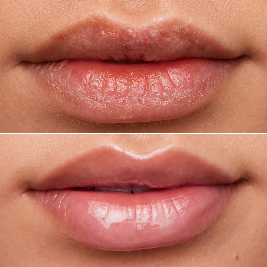 Wonderskin Lip Rehab Serum Oil lipolie Clear met sheaboter