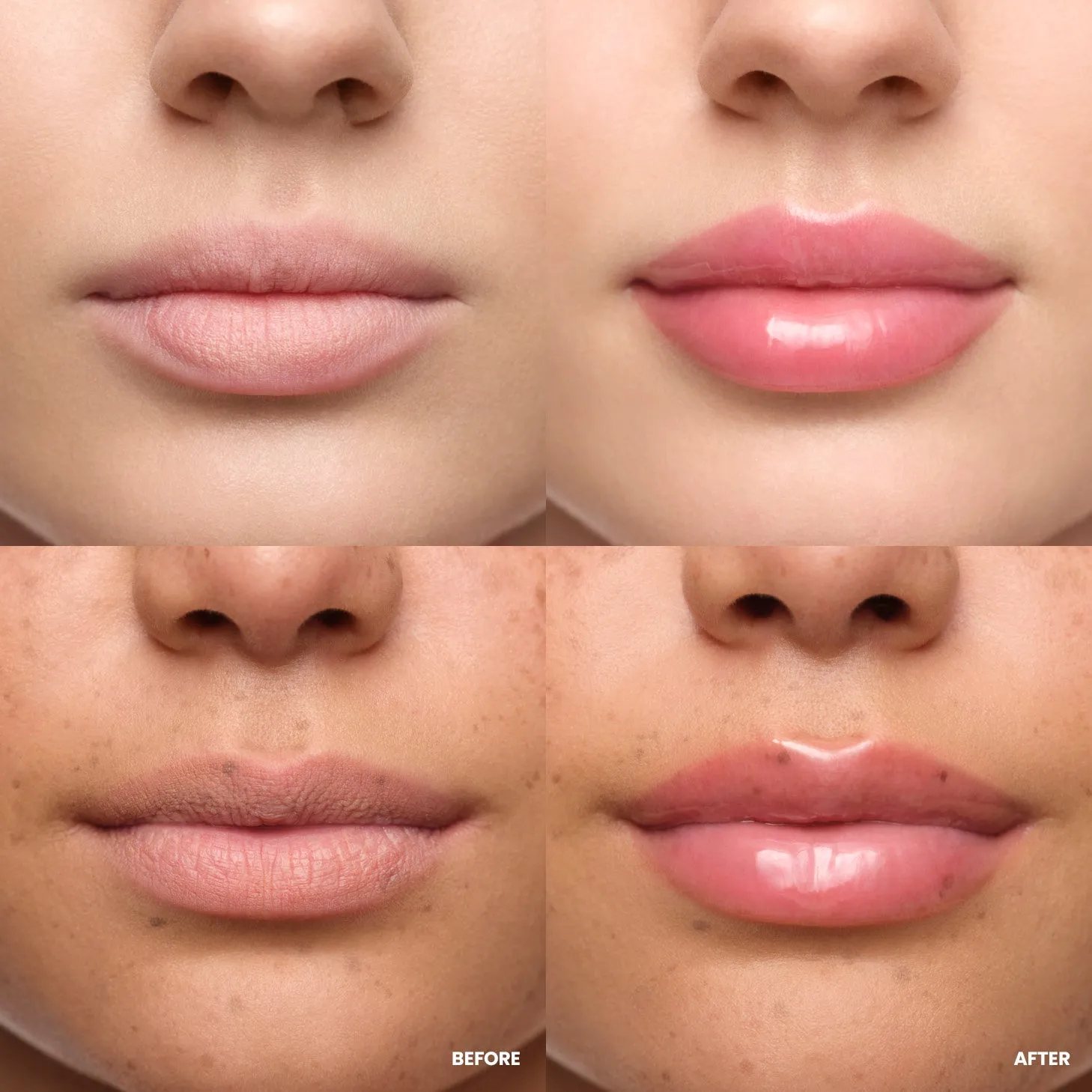 Wonderskin Lip Relapse Plumping Gloss Lipgloss Clear